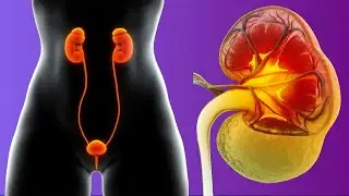 Nephritis: Symptoms And Treatment