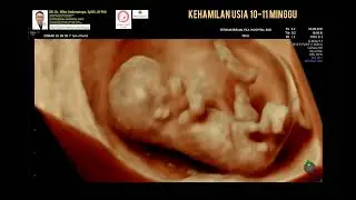 Kehamilan 10-11 minggu