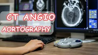CT ANGIO AORTOGRAPHY WITH ECG GATED فحص  أشعة مقطعية بالصبغة على الشريان الاورطى