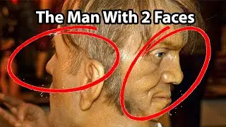 The Man With 2 Faces | The Mysterious Story Of Edward Mordrake