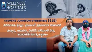 Steven Johnson Syndrome (SJS)|| General Medicine||Medical Teamwork|| @Wellness Hospitals