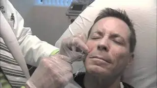 Juvederm &ndash; Look Ten Years Younger in Seconds | Dr. Alex Martin | MetroMD
