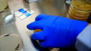 Yeast identification