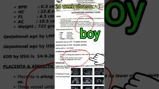 baby boy sonography।24 week ultrasound। ultrasound showing baby boy #shorts #ytshortsindia #babyboy