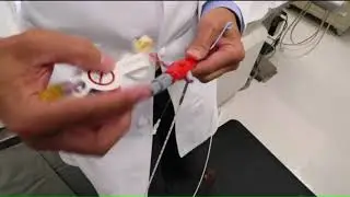 SLU Hospital first in the region to adopt the Impella device for cardiac patients