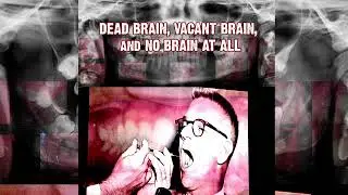 DEADBRAIN, Vacant Brain, and No Brain At All