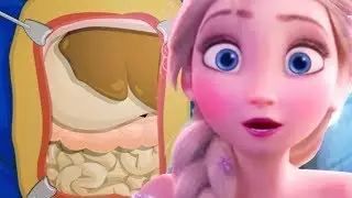 Elsa Large Intestine Surgery Online Game