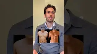 Abdominal etching/High definition liposuction