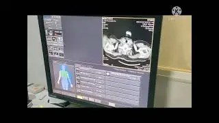 CECT Chest procedure and planning