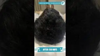 മുടി കൊഴിയുന്നുണ്ടോ? ഇനി Stem cell Activation വഴി മുടി വളരും!