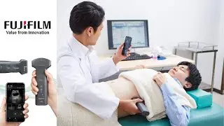 iViz wireless- Pocket size wireless ultrasound