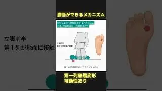 歩行によって胼胝ができるメカニズム⑤第一列底屈変形（可動性あり） #理学療法 #ptタイガー #日本足病学協会 #足病学