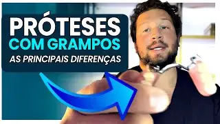 Por que o grampo da prótese dói?