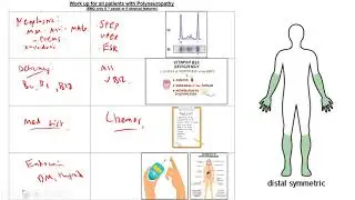 Morning Report: Peripheral Neuropathy, Mononeuritis Multiplex, and approach to Paraproteinemia