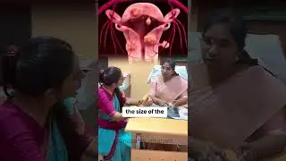 Fibroid vs Vaginalbirth !