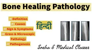 Bone Healing !! Causes !! Sign & Symptoms!! Gross & Microscopic Pathology!! Pathogenesis !! Hindi !!