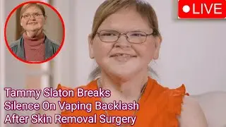 1000-Lb Sisters&rsquo; Tammy Slaton Breaks Silence On Vaping Backlash After Skin Removal Surgery...!!