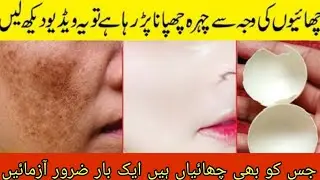 HOW TO REMOVE PIGMENTATION AT HOME||3 AMAZING & MONEY SAVING HACKS 🤩