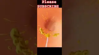 Ear cleaning asmr | ear cleaning video #shorts #shortsvideo #shortfeed #earcleaningasmr