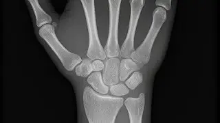 🎵 Sing Along & Never Forget the 8 Carpal Bones! | Wrist Fracture Jam/Anatomy song/ USMLE song 