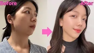 Get Rid of Double Chin, Chubby Cheeks and Jawline in 2 Minutes 🔥 Beginners. #jawline #doublechin #yt