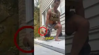 ХУДШИЙ способ ушибить палец ноги 😩