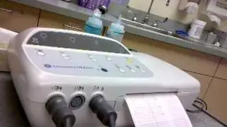 Non-Stress Test