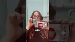 New gadget for Dental photo 📸