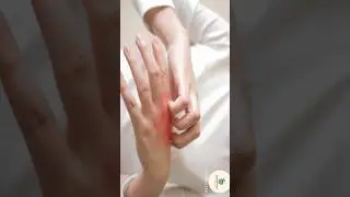 cipro -CF Cream skin mein fungal infection, skin mein bacterial infection#skincare