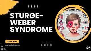 Pediatric Syndromes | Sturge-Weber Syndrome: CF, Dianosis & Managment