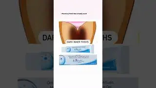 BEST PHARMACY CREAM - THEY WILL CHANGE YOUR SKIN FOREVER. #indianskincare #unsponsored