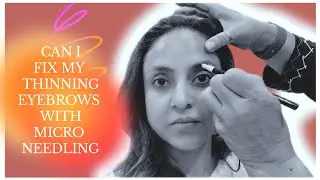 CAN I FIX MY THINNING EYEBROWS WITH MICROBLADING ???