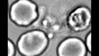 Finding Malaria's Weak Spot