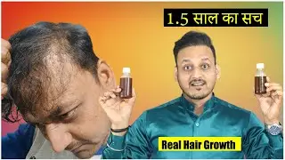Used Hair Oil & Serum for 1.5 years | Before After Hair Growth Result 😱 | Real Experience