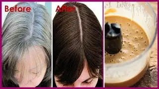 A Natural Trick to Remove White Hair Permanently Fast Just in Single Apply