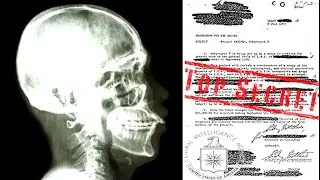 The Secret Mind Control Experiments The CIA Tried To Hide From The World