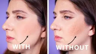 Simple Powder Trick For Pitted Acne Scars