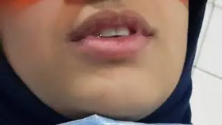 علاج مشاكل ومنها سن مدفون  وسن ناقص.Ortho Treat of Impacted Tooth.d