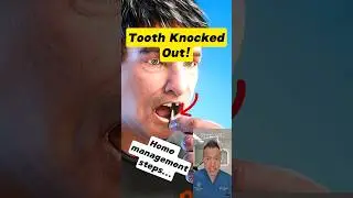 Emergency Tips: Saving a Knocked-Out Tooth at Home #dentallan #dentist #shorts