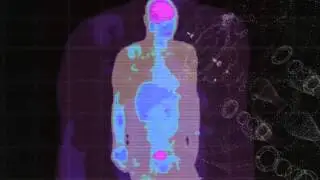 IBA Технология Cyclone