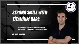 All-on-4 & All-on-6: Benefits of Titanium Bars