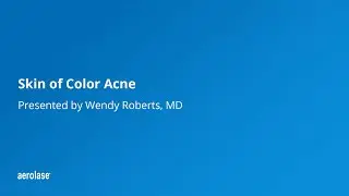 Skin of Color and Acne by Wendy Roberts, MD