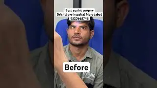 Life changing result | squint surgery | cosmetic surgery | Drishti Eye hospital Moradabad #doctor