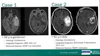 Neurosurgery Grand Rounds - Disappearing Spoon Disappearing Cancer Dr Connelly, MD 10 12 2023