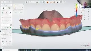 ortho planner, meshmixer, splint studio and implant studio