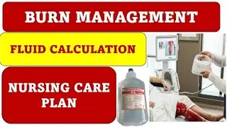 Burn management#Fluid calculation#Nursing care plan on burn injury#medical