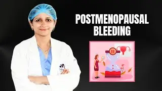 Postmenopausal Bleeding: Causes, Risks & When to Seek Help
