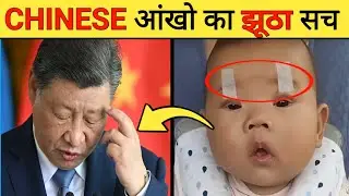 Why Chinese Parents Tape Baby's Eyelids | Aankh Par Tape Kyu 😱