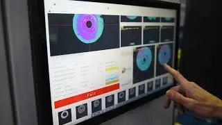 Casting Inspection System