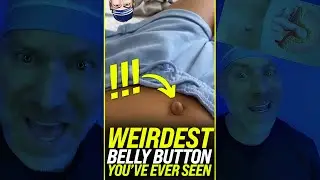Weirdest Belly Button You&rsquo;ve Ever Seen 🤯 #shorts